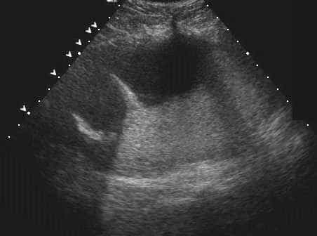 case0110-i