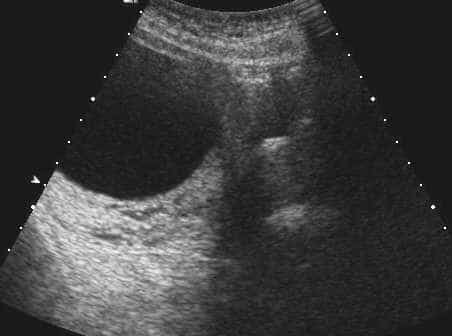 case0110-l