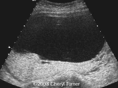 case0110-n
