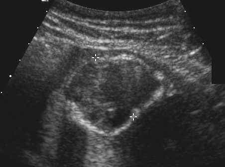 case0110-o