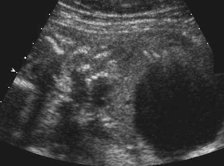 case0110-p