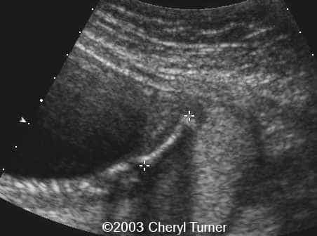 case0110-q