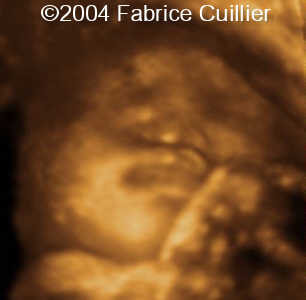 case0111-1