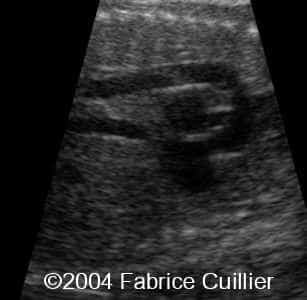 case0111-11