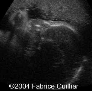 case0111-12
