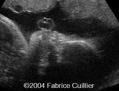 case0111-13