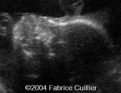 case0111-18