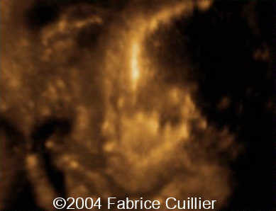 case0111-20