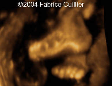 case0111-21
