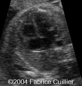 case0111-4