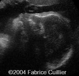 case0111-5
