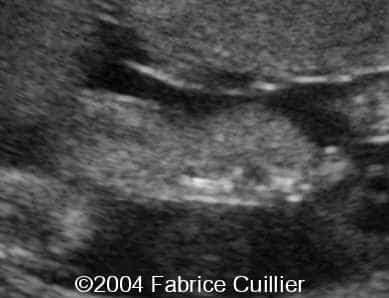 case0111-6