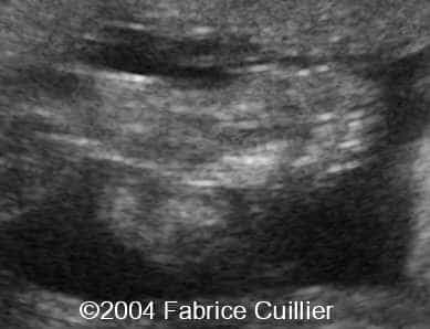 case0111-7