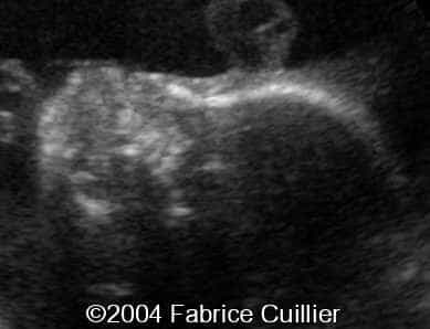 case0111-8