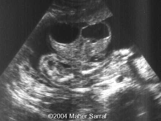 case0112-2