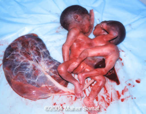 case0112-5