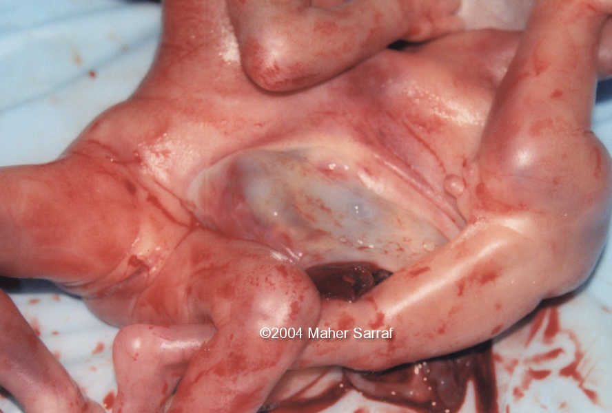 case0112-6