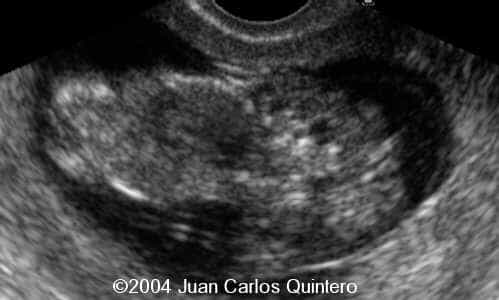 case0115-1