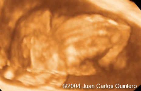 case0115-2