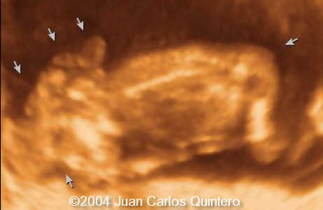 case0115-3