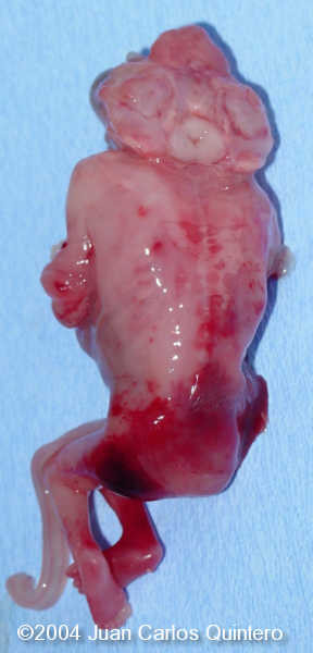 case0115-5