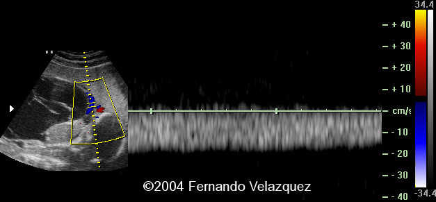Case0116-1