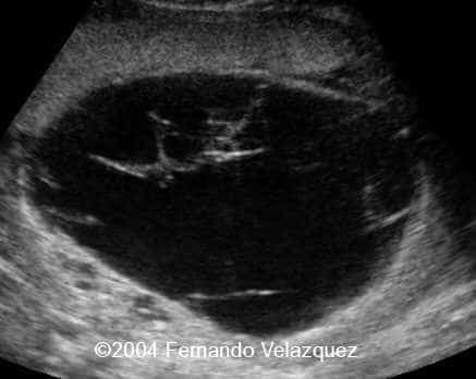 case0116-2