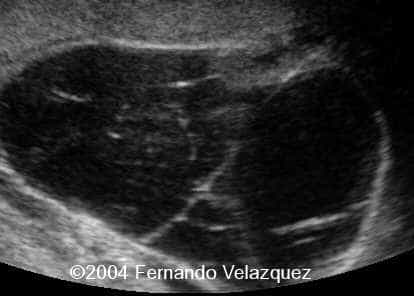 case0116-5