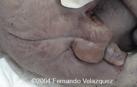 case0116-7