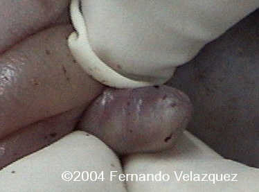 case0116-9