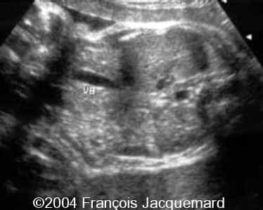case0124-1