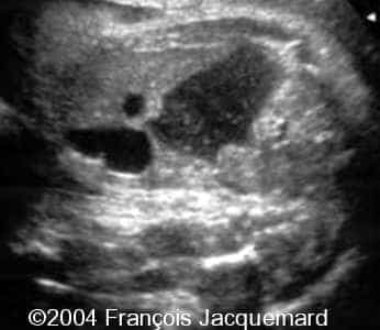 case0124-3