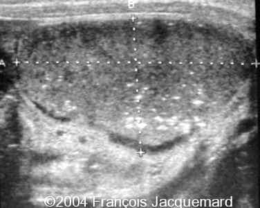 case0124-4