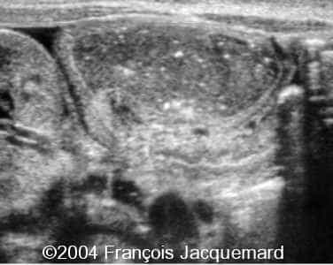 case0124-5