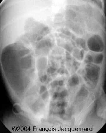 case0124-6