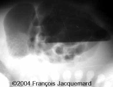 case0124-7