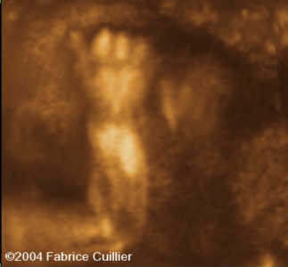 case0125-12