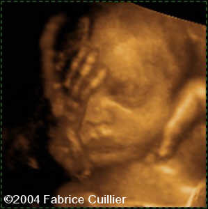 case0125-13