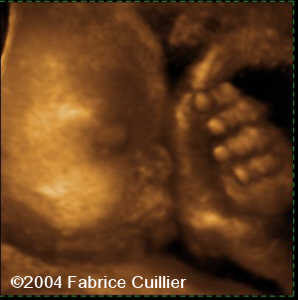 case0125-14