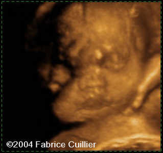 case0125-15