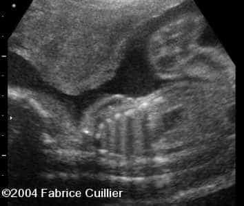 case0125-6