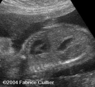 case0125-8