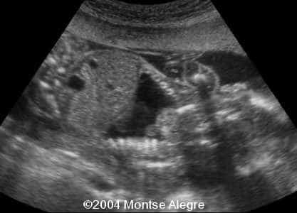 case0126-3