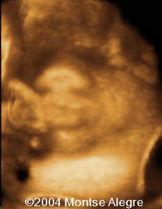 case0126-5