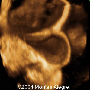 case0126-6