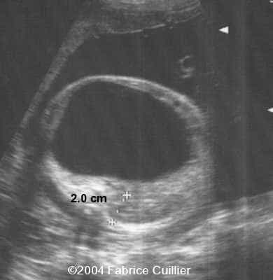 case0128-1