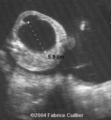 case0128-2