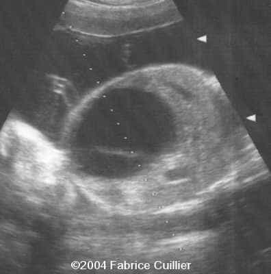 case0128-3