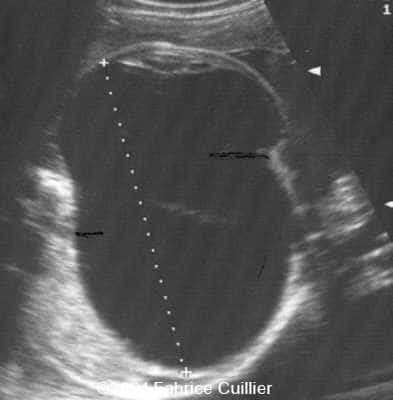 case0128-4