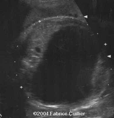 case0128-5